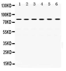 Anti-TRAP1 Antibody Picoband® Boster Bio