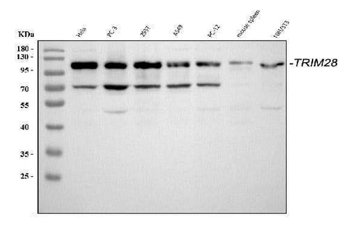 Anti-KAP1/TRIM28 Antibody Picoband® Boster Bio