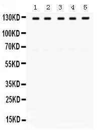 Anti-TRPM8 Antibody Picoband® Boster Bio