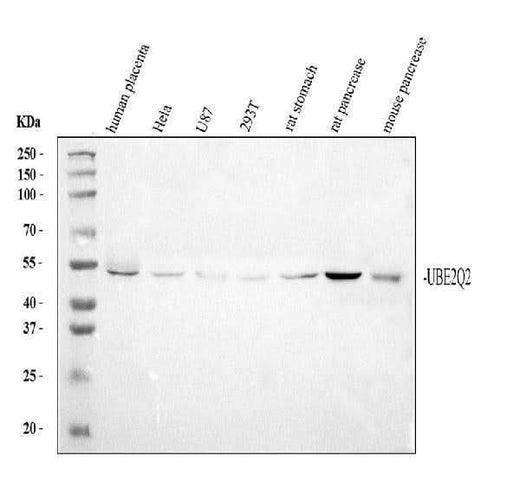 Anti-UBE2Q2 Antibody Picoband® Boster Bio