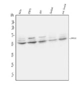 Anti-UPF3B/RENT3B Antibody Picoband® Boster Bio