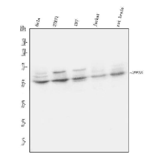 Anti-UPF3B/RENT3B Antibody Picoband® Boster Bio