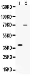 Anti-CD46 Antibody Picoband® Boster Bio