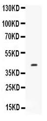 Anti-Factor D/CFD Antibody Picoband® Boster Bio