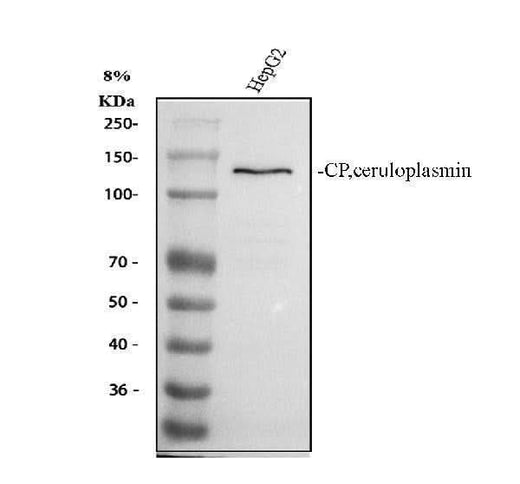 Anti-Ceruloplasmin/CP Antibody Picoband® Boster Bio