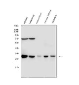Anti-Cathepsin G/CTSG Antibody Picoband® Boster Bio