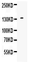Anti-EGF Antibody Picoband® Boster Bio
