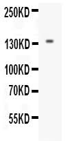 Anti-EGF Antibody Picoband® Boster Bio
