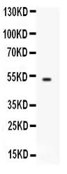 Anti-FCGRT Antibody Picoband® Boster Bio