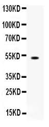 Anti-FCGRT Antibody Picoband® Boster Bio