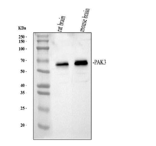 Anti-PAK3 Antibody Picoband® Boster Bio
