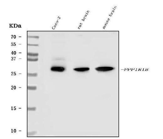 Anti-DARPP32/PPP1R1B Antibody Picoband® Boster Bio