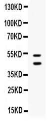 Anti-EPCR/CD201/PROCR Antibody Picoband® Boster Bio