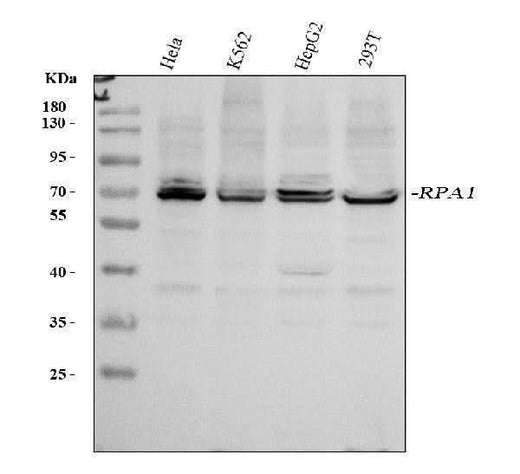 Anti-RPA70/RPA1 Antibody Picoband® Boster Bio