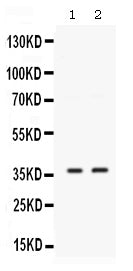 Anti-SIX1 Antibody Picoband® Boster Bio