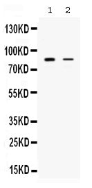 Anti-SMURF1 Antibody Picoband® Boster Bio