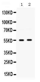 Anti-SMYD3 Antibody Picoband® Boster Bio