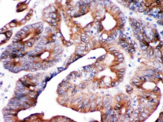 Anti-SPTLC1 Antibody Picoband® Boster Bio