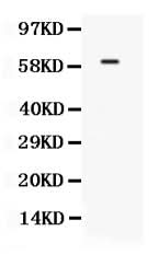 Anti-TCF7L1 Antibody Picoband® Boster Bio