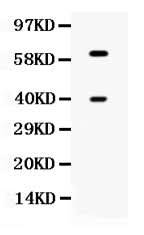 Anti-TPP1 Antibody Picoband® Boster Bio