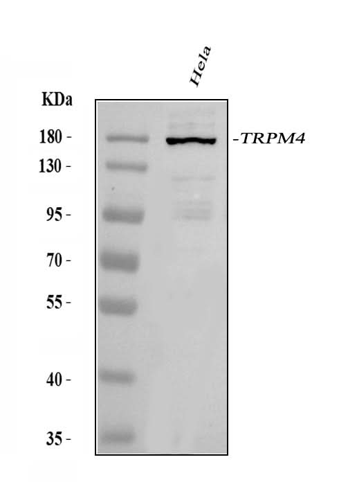 Anti-TRPM4 Antibody Picoband® Boster Bio