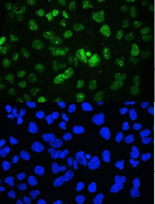 Anti-YY1 Antibody Picoband® Boster Bio