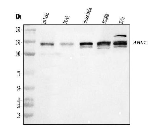 Anti-ABL2 Antibody Picoband® Boster Bio
