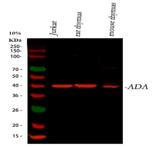 Anti-ADA Antibody Picoband® Boster Bio