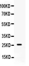 Anti-Apolipoprotein A I/APOA1 Antibody Picoband® Boster Bio