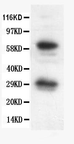 Anti-Bcl-X/BCL2L1 Antibody Picoband® Boster Bio