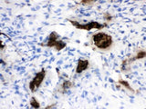Anti-Osteocalcin/BGLAP Antibody Boster Bio