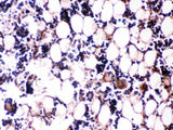 Anti-Osteocalcin/BGLAP Antibody Boster Bio