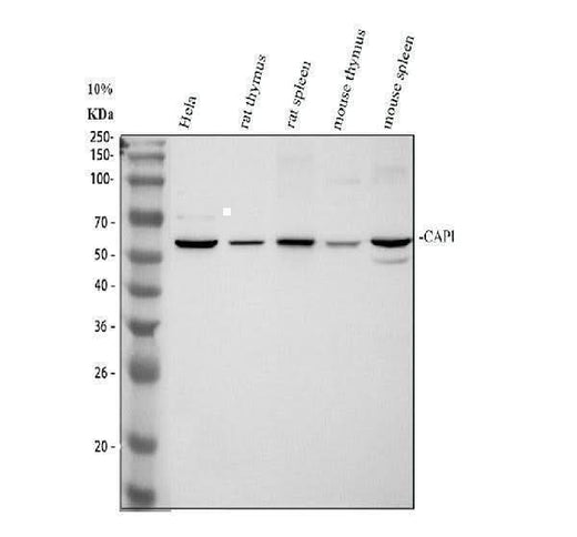 Anti-CAP1 Antibody Picoband® Boster Bio
