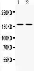 Anti-Calcium Sensing Receptor/CASR Antibody Picoband® Boster Bio