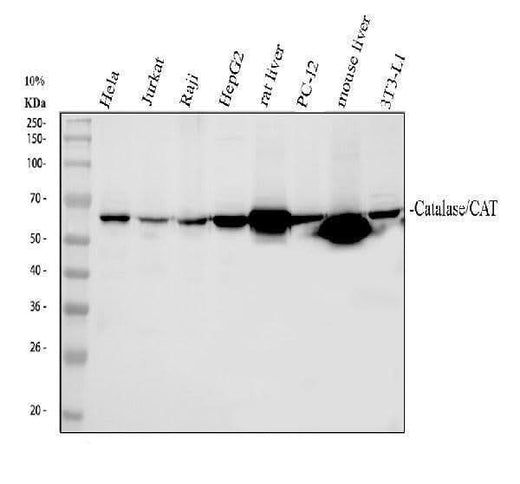 Anti-Catalase Antibody Picoband® Boster Bio