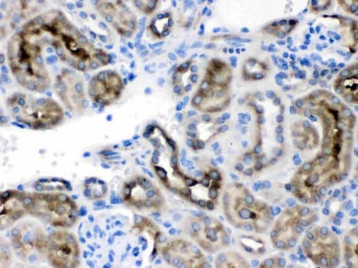 Anti-TCP1 delta/CCT4 Antibody Picoband® Boster Bio