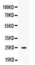 Anti-CD9 Antibody Picoband® Boster Bio
