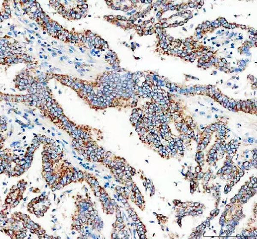 Anti-Calcitonin/CALCA Antibody Boster Bio