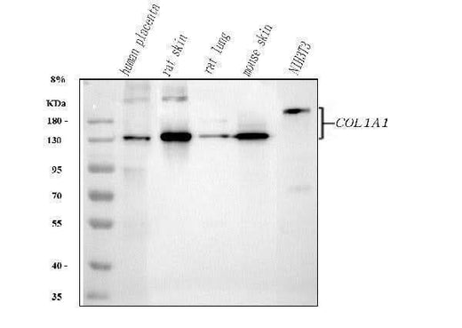 Anti-Collagen I/COL1A1 Antibody Picoband® Boster Bio