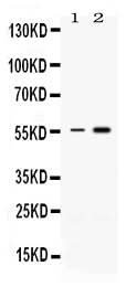 Anti-MEF2A Antibody Picoband® Boster Bio