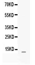 Anti-MGP Antibody Picoband® Boster Bio