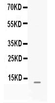 Anti-MGP Antibody Picoband® Boster Bio