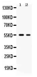 Anti-Glucose Transporter 5 GLUT5/SLC2A5 Antibody Picoband® Boster Bio