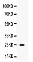 Anti-HE4/WFDC2 Antibody Picoband® Boster Bio