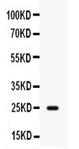 Anti-HE4/WFDC2 Antibody Picoband® Boster Bio