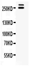 Anti-WNK1 Antibody Picoband® Boster Bio