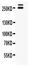 Anti-WNK1 Antibody Picoband® Boster Bio
