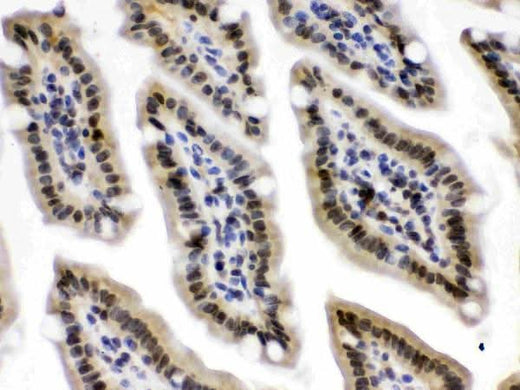 Anti-CRM1/XPO1 Antibody Picoband® Boster Bio