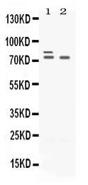 Anti-Plzf/ZBTB16 Antibody Picoband® Boster Bio