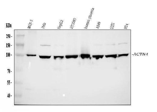 Anti-Alpha Actinin 4/ACTN4 Antibody Picoband® Boster Bio